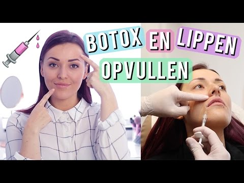 Vlogging – free botox treatment -  Dutch Social Media Code